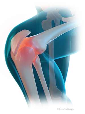 Auto Accident Injury Treatment