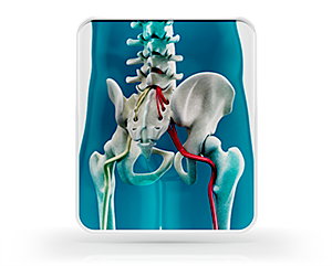 Sciatica Treatment